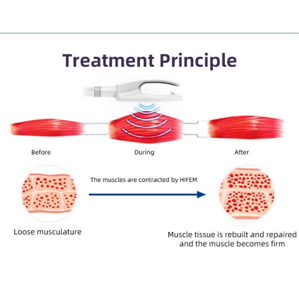 Cost Effecttive EMS Body Slimming Machine Portable Body Shape Machine