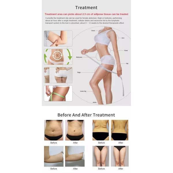 Advanced 5Mhz Rf Frequency Slimming Machine with 50r/min Roller Speed