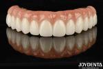 High Biocompatibility Ti-Bar Zirconia Hybrid Bridge For Precise Fit And Missing