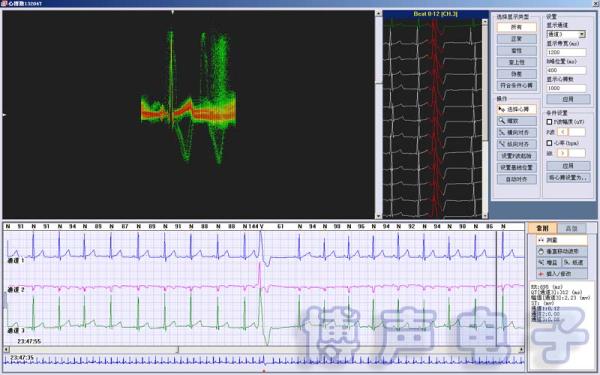 Buy iTengo+ Holter ECG Analysis Software System Workstation Holter Monitor at wholesale prices