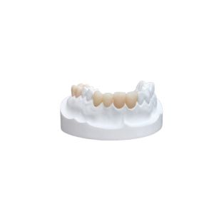 Buy cheap Inlays Onlays Ceramic Dental Crown Strong Veneer For Dental Department from wholesalers
