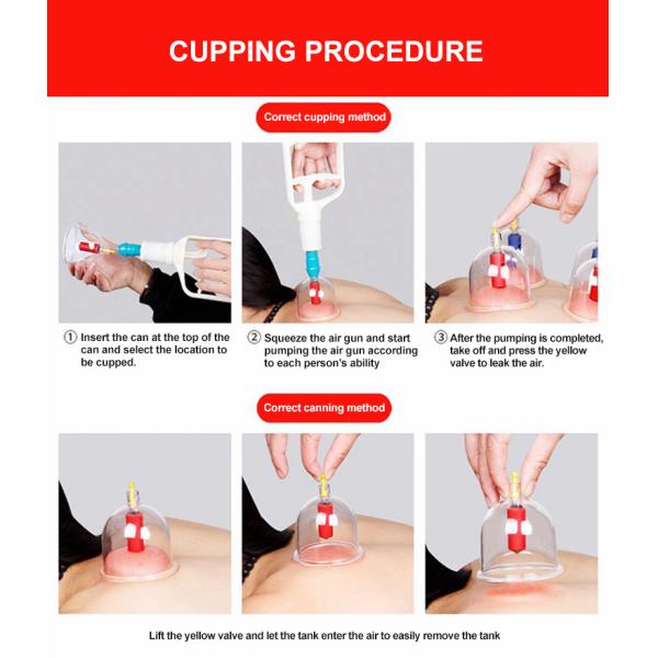 24pcs Per Box Medical Vacuum Suction Cups Transparent Environment Friendly