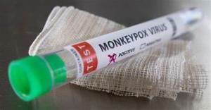 Quality Monkeypox Virus Detection Reagent Real Time PCR Kit for sale