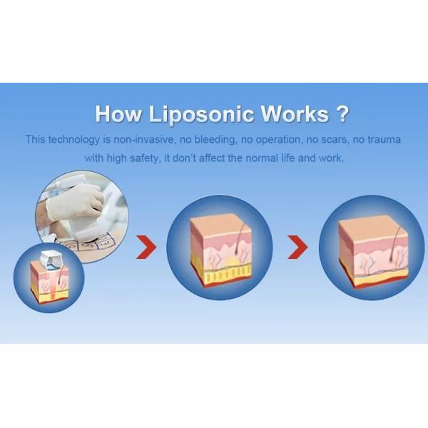 Advanced 5Mhz Rf Frequency Slimming Machine with 50r/min Roller Speed