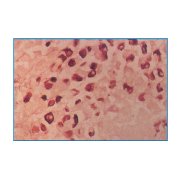 Virus Stain (Orcein staining method)