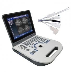 China TGC Control Notebook Ultrasound Scanner For Pregnancy Home Use on sale