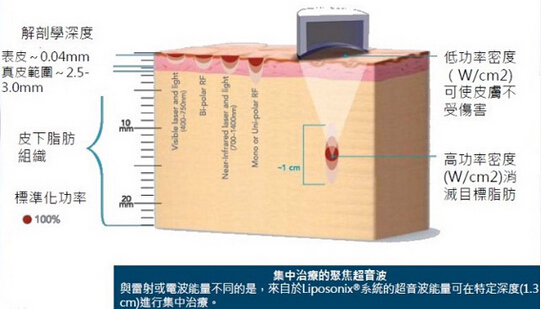 CE approval most professional good result body slimming HIFUshape slimming device for salon use