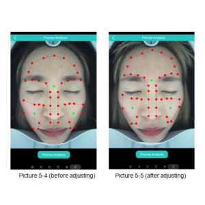 Powerful 3D Digital Skin Analysis Machine Cloud Sharing Android Software