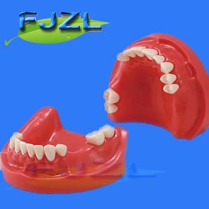 China dental model for partial denture restorative on sale