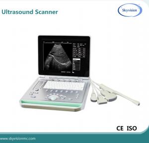 China Best Value 15 inch LED monitor Ultrasound Machine/Portable Ultrasound Scanner for Hospital on sale