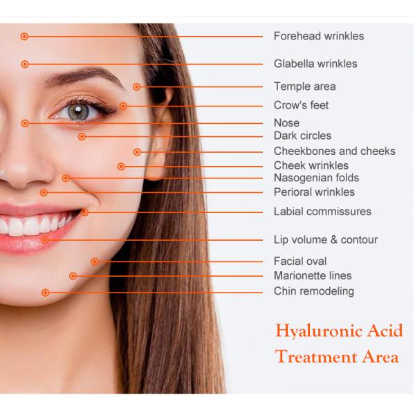 10ml 20ml 24mg Hyaluronic Acid Dermal Filler Injectable