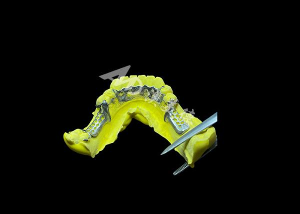 Buy Tailored Cast Partial Denture with Personalized Aesthetics and Secure Fit for Enhanced Comfort and Functionality at wholesale prices