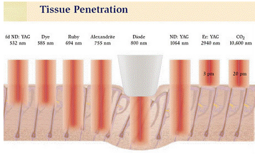 IPL Permanent Hair Reduction High Performance lightsheer diode laser hair removal equipment