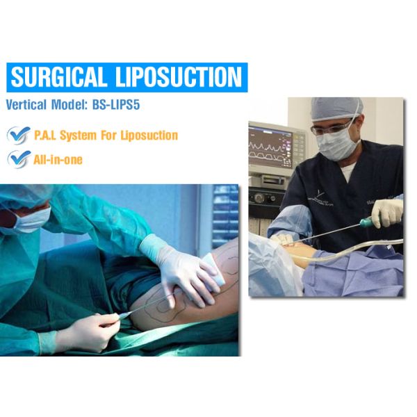 Shaping Body Surgical Liposuction Machine Lipo Slim Machine For Chin / Outer Thighs