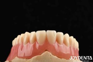 China Good Elasticity Acrylic Denture Finish For Lightweight Personalized Customization And Customized Design on sale
